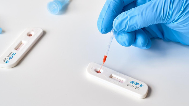 Parceria ampliará testagem para covid em mais 23 pontos