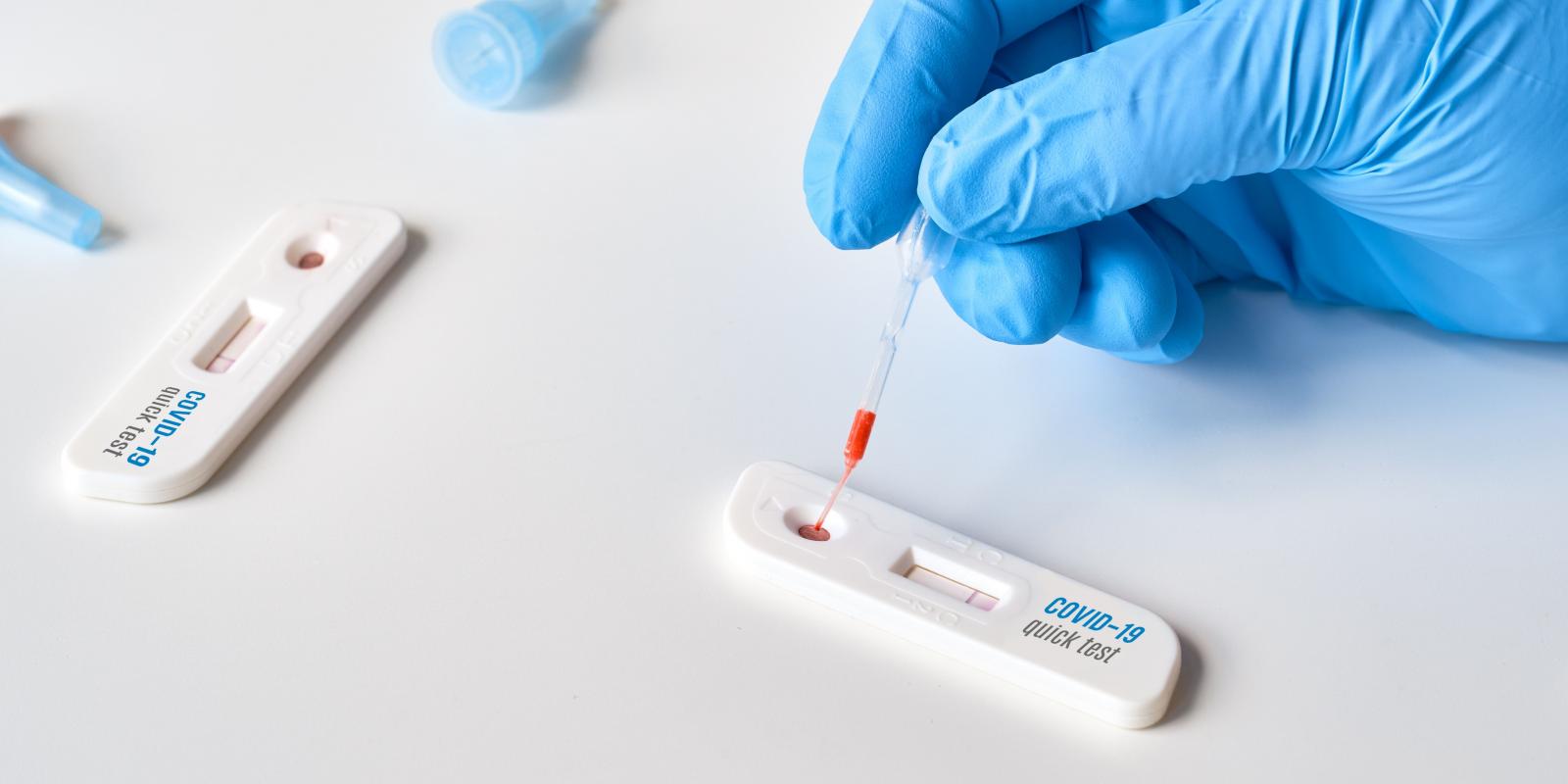 Parceria ampliará testagem para covid em mais 23 pontos